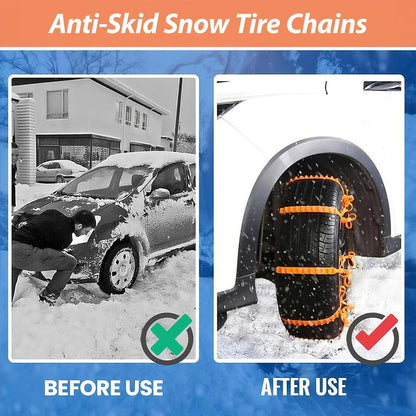 🔥Black Friday Special | Universal Anti-Skid Snow Tire Chains(10 PCS)